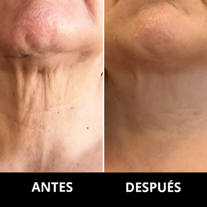 Toessence DermaLift - Rodillo Reafirmante · Crema para un cuello más firme y definido